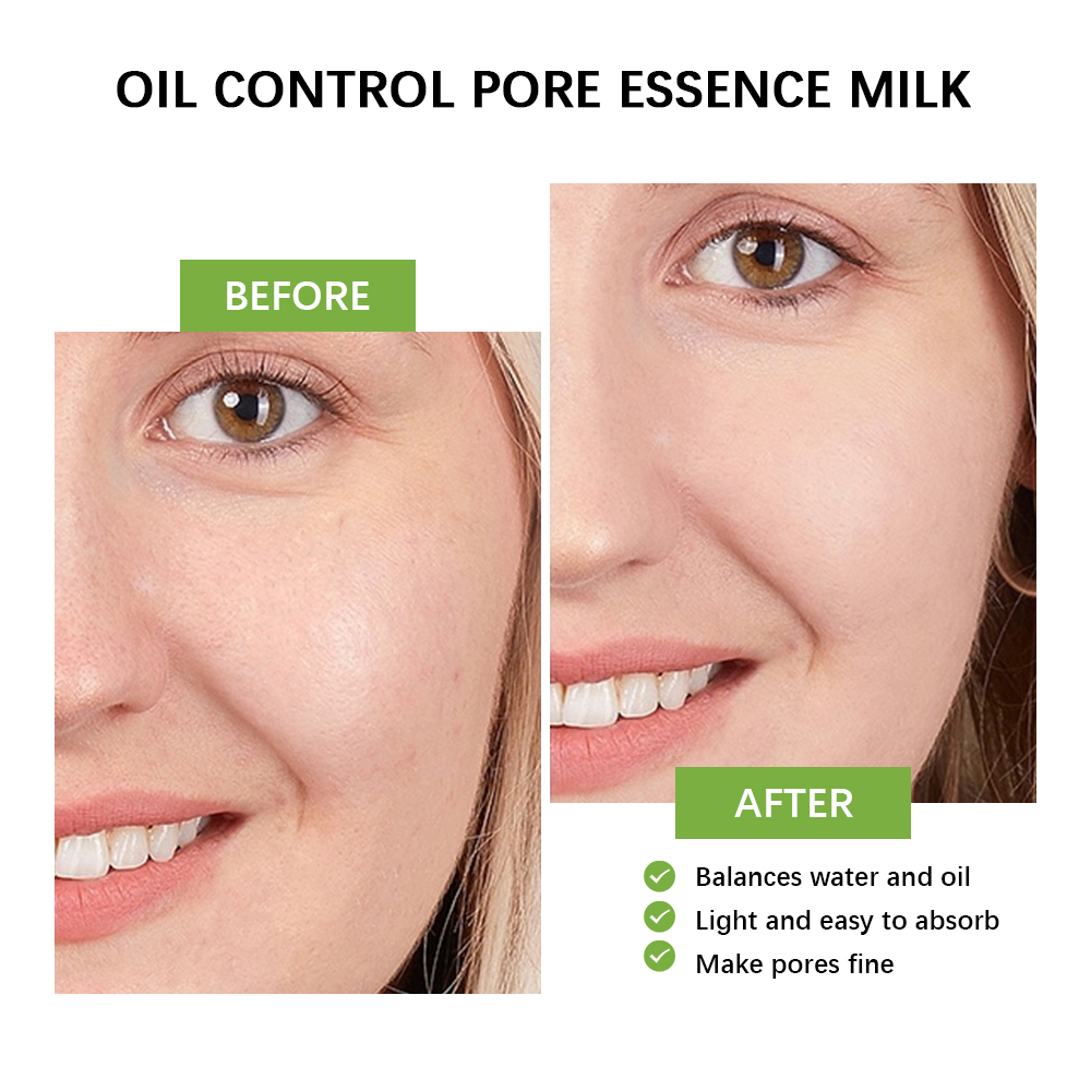 Праймер для лица с молочной эс – обзор и цена Ferulic Acid Serum